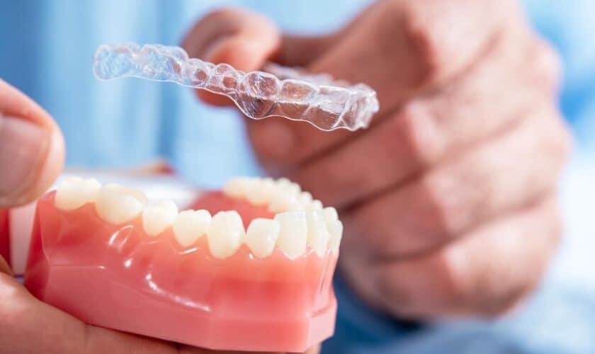 Invisible Braces: Discreet Orthodontic Solutions For Adults